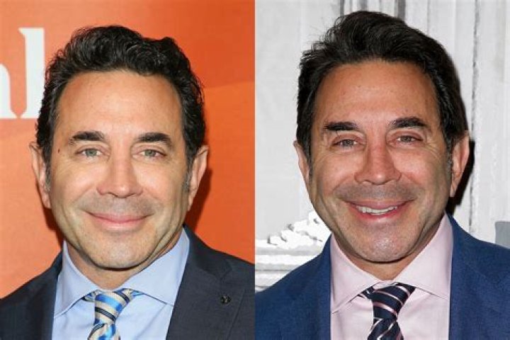 Paul Nassif (Médico) - Idade, aniversário, biografia, fatos, família, patrimônio líquido, altura e muito mais
