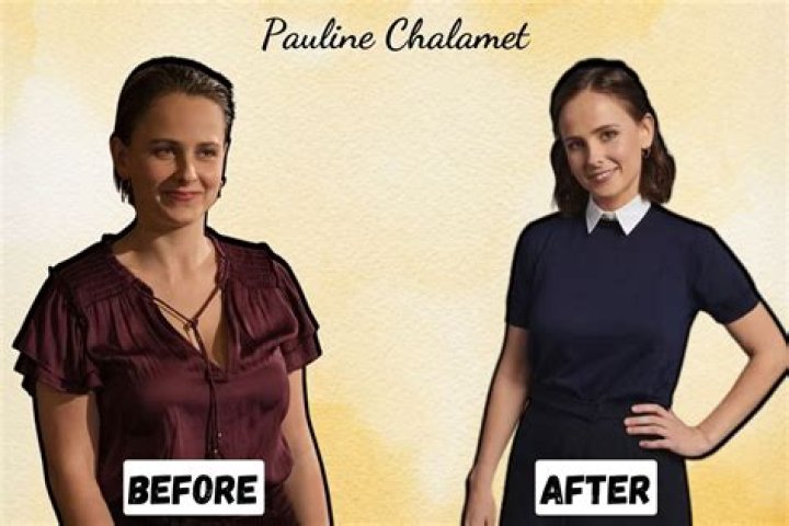 Pauline Chalamet Breast Reduction: Timothee Chalamet Sister Weight Loss Before And After Age