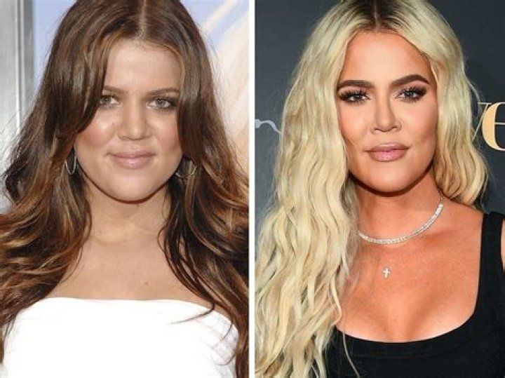 Plastic Surgery? Khloé Kardashian’s Latest Selfie Slammed For Looking “Fake”