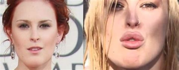 Plastic Surgery? Rumer Willis’ Latest Instagram Post Has Fans Wondering If She Got Lip Injections
