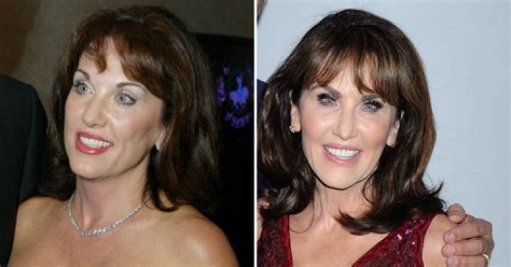 Robin McGraw Wiki, Net Worth, Plastic Surgery, Age, Twin Brother, Sister, Height. 2022