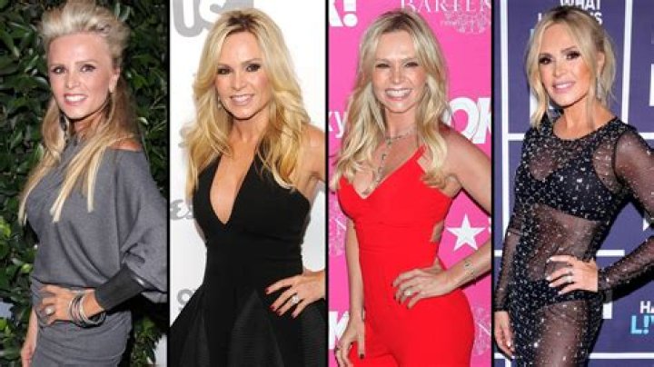 Has RHOC’s Tamra Judge Had Plastic Surgery? See Her Transformation Photos, Quotes