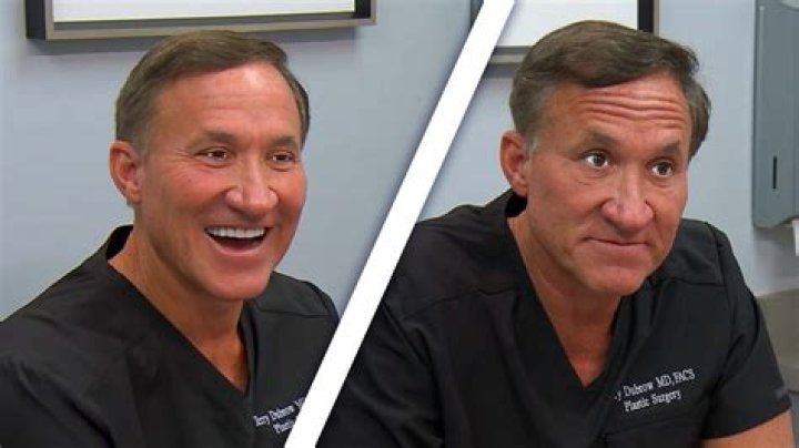 
Terry Dubrow | Weight Loss | Before And After 