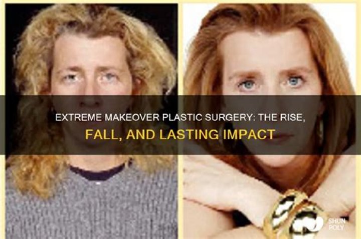 The OG ‘Extreme Makeover’ Was Way More Controversial (and Way Less Successful) Than ‘Home Edition’