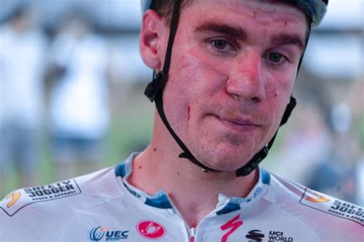 
What Happened To Fabio Jakobsen Face? 