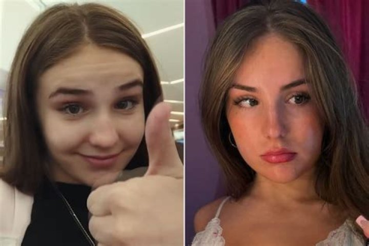 
What Happened To Katie Piper? Where Is She Now 