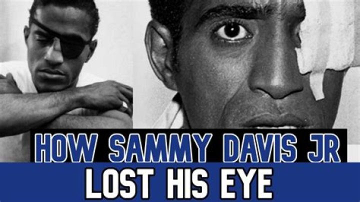 What happened to Sammy Davis Eye? – Celebrity.fm – #1 Official Stars, Business & People Network, Wiki, Success story, Biography & Quotes