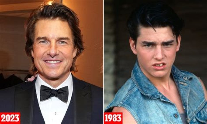 
What Is Wrong With Callan Rydz Teeth? Before And After Photo 