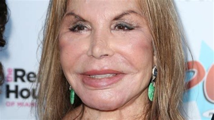 What is wrong with Marisol’s mother’s face?