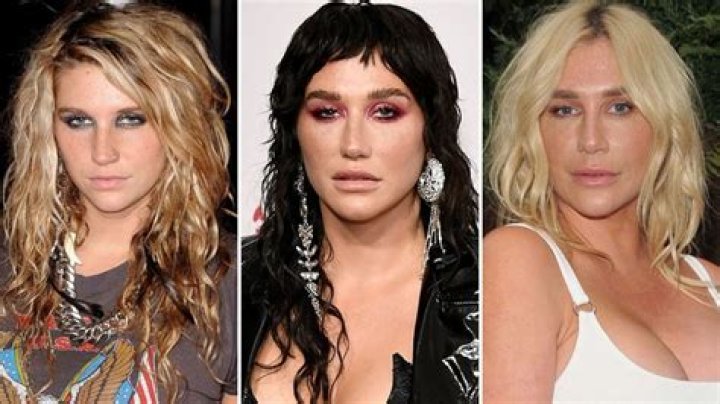 Where Is Kesha Now After Health Diagnosis? See Career and Life Updates After Stardom