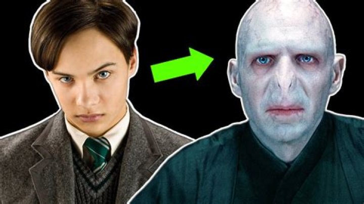 Why Does Harry have a yellow eyebrow? – Celebrity.fm – #1 Official Stars, Business & People Network, Wiki, Success story, Biography & Quotes