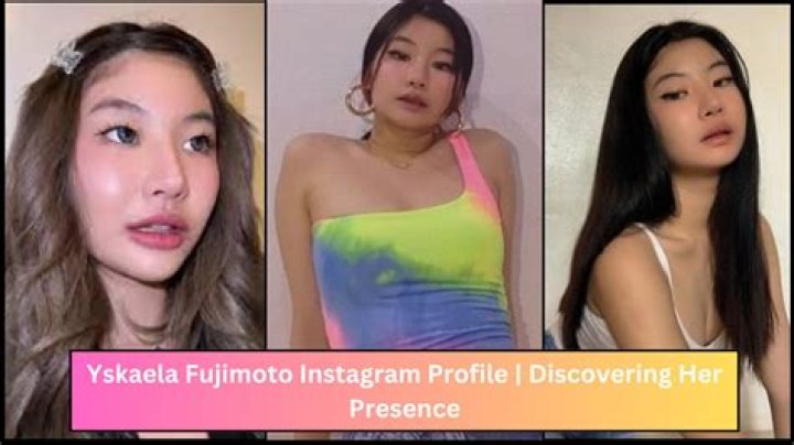 
Yskaela Fujimoto Before Surgery: What Is Wrong With Her Face? Viral Video 