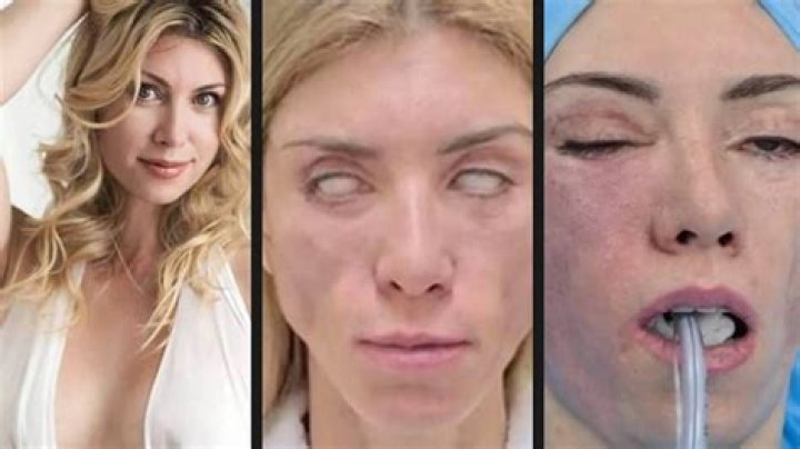 Wiki, Biography, Age, Plastic Surgery, Net worth, Height, Husband, Family & More