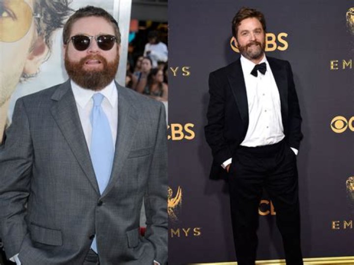 Zach Galifianakis Shows off His 50-Pound Weight Loss — “Being Light’s Fun!”
